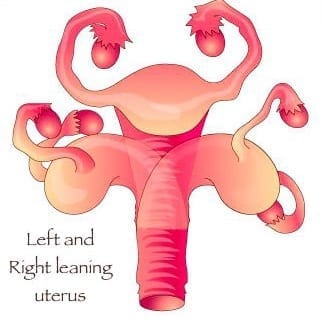 Can The Uterus Be Trained To Stay?