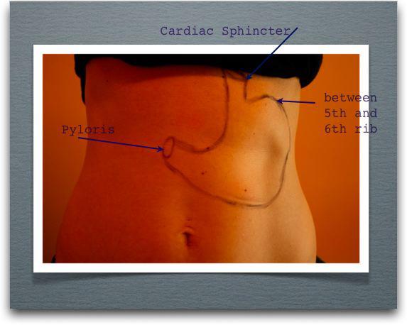 Hyperkyphosis and Ptosis, Oh My!