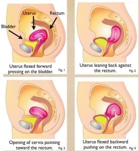 Uterine-Positions