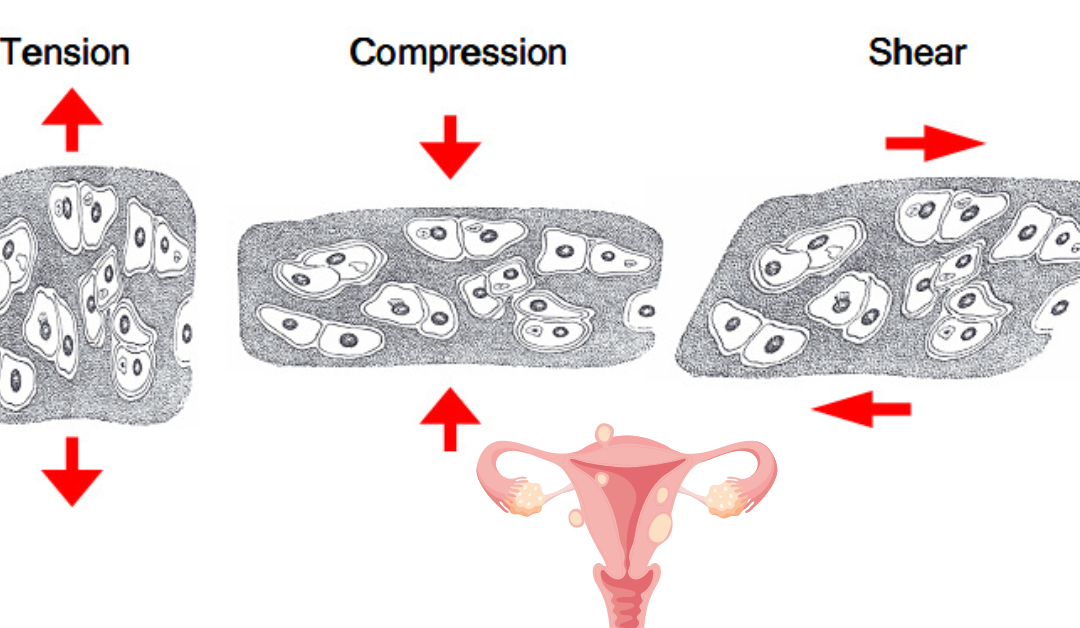 Mechanotransduction and Fibroid Formation