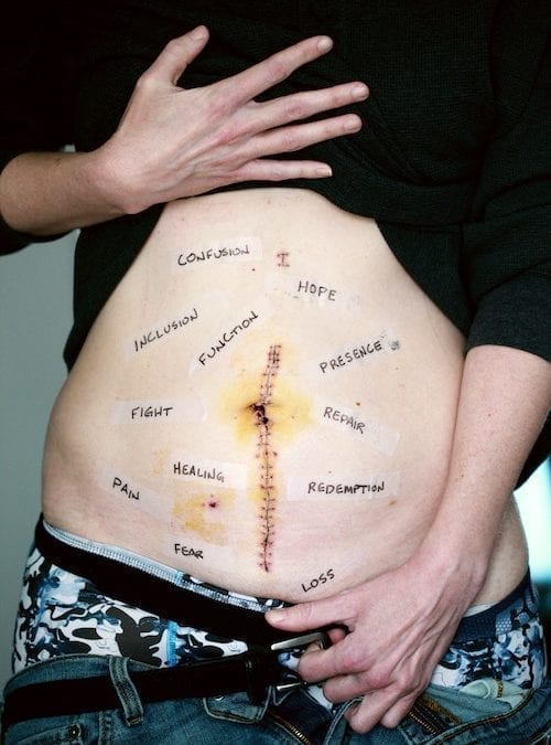 Massage for gastroparesis Clearance