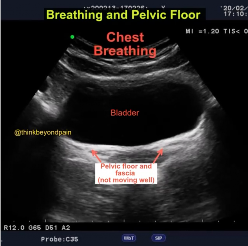 image of the bladder and pelvic floor dynamics